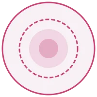 Materiale adattivo flessibile del correttore nasale